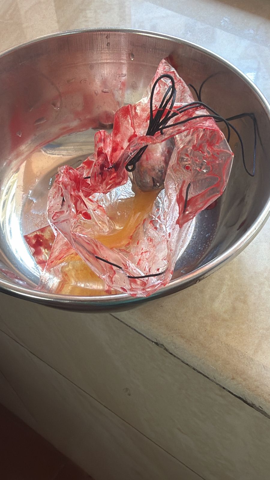 Dr. Mariam Anjum — Surgical Specimen
